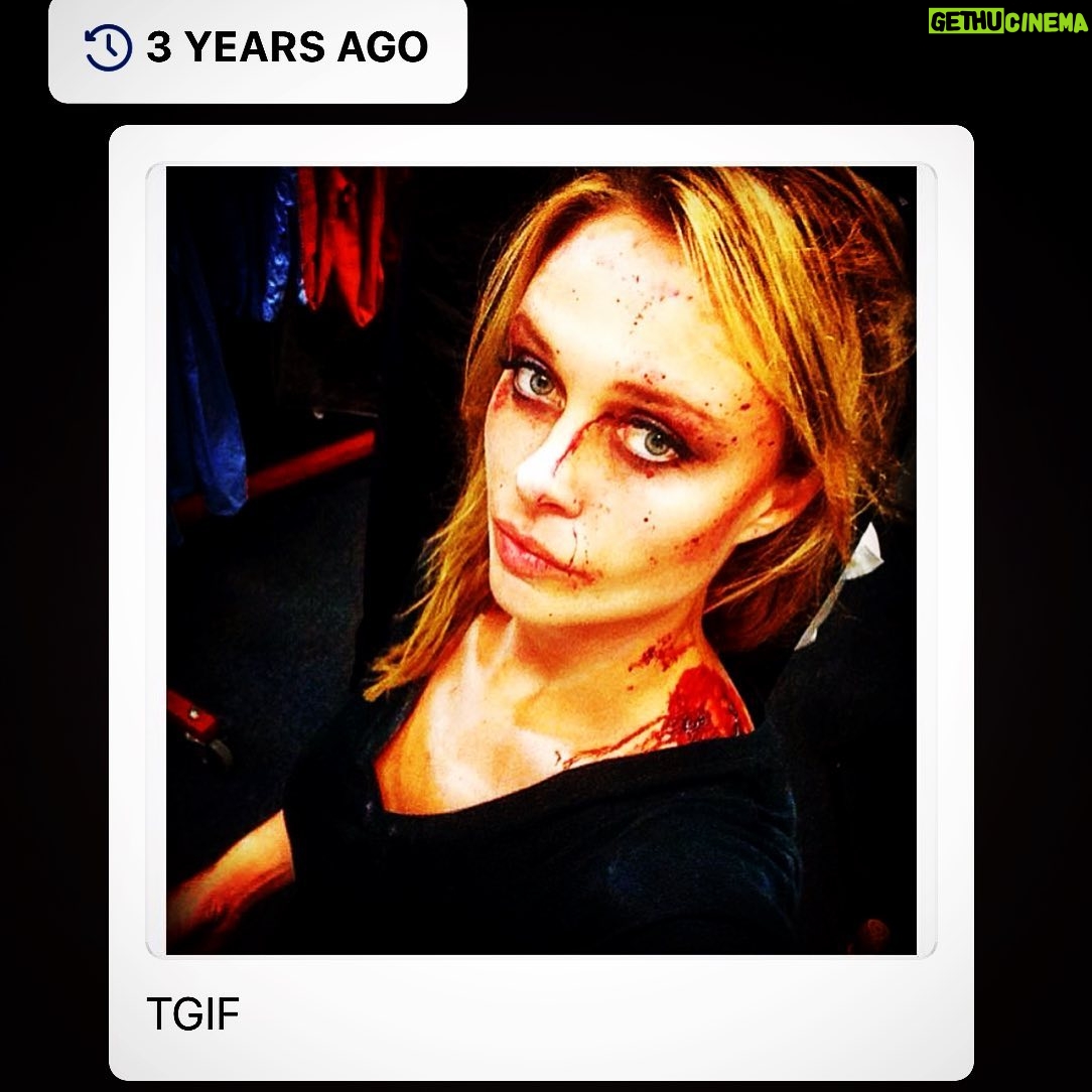 Madison McKinley Instagram - Thanks 4 the reminder FB. 👀 3 yrs ago today ... I got shot ~Low & Behold ~💥 🎬 (next year I’ll be more careful)