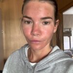 Maja Bohosiewicz Instagram - Poszłam na zabieg green sea peel w @estetic_point_warszawa_ - powiem tak, uczucie wcierania kawałków szkła w twarz mało przyjemne ale ze znieczuleniem łatwiej. Ale zobaczyć swoją twarz następnego dnia która jest czerwona i opuchnięta jak pijaka spod sklepu lekko przerażająca. Drugi dzień robi się już lepiej i wyglądam tylko jakby mnie spaliło mocniej słońce. Finalny efekt za parę dni ale to już moje drugie podejście i bardzo polecam z całego serca na przebarwienia! Byłyście kiedyś na takim hardkorowym zabiegu? Jakieś ostre peelingi? Co polecacie?