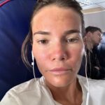Maja Bohosiewicz Instagram - Poszłam na zabieg green sea peel w @estetic_point_warszawa_ - powiem tak, uczucie wcierania kawałków szkła w twarz mało przyjemne ale ze znieczuleniem łatwiej. Ale zobaczyć swoją twarz następnego dnia która jest czerwona i opuchnięta jak pijaka spod sklepu lekko przerażająca. Drugi dzień robi się już lepiej i wyglądam tylko jakby mnie spaliło mocniej słońce. Finalny efekt za parę dni ale to już moje drugie podejście i bardzo polecam z całego serca na przebarwienia! Byłyście kiedyś na takim hardkorowym zabiegu? Jakieś ostre peelingi? Co polecacie?
