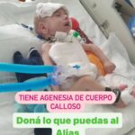 María Valenzuela Instagram - ❤️🙏Les presentamos a Mateo ,Mateo tiene Agenesia de cuerpo calloso ,dilatación pielocalicial izquierda, hiperbilirubinemia y malformación cerebral necesitamos recaudar $2.000.000 ( ese dinero será utilizado para su tratamiento 🙌),ayudemos a Mateo a seguir viviendo . Doná lo que puedas al Alias 👉AYUDAR.SALVA ❤️🙏 Contamos con ustedes?! Si no podes donar , nos ayudas compartiendo.