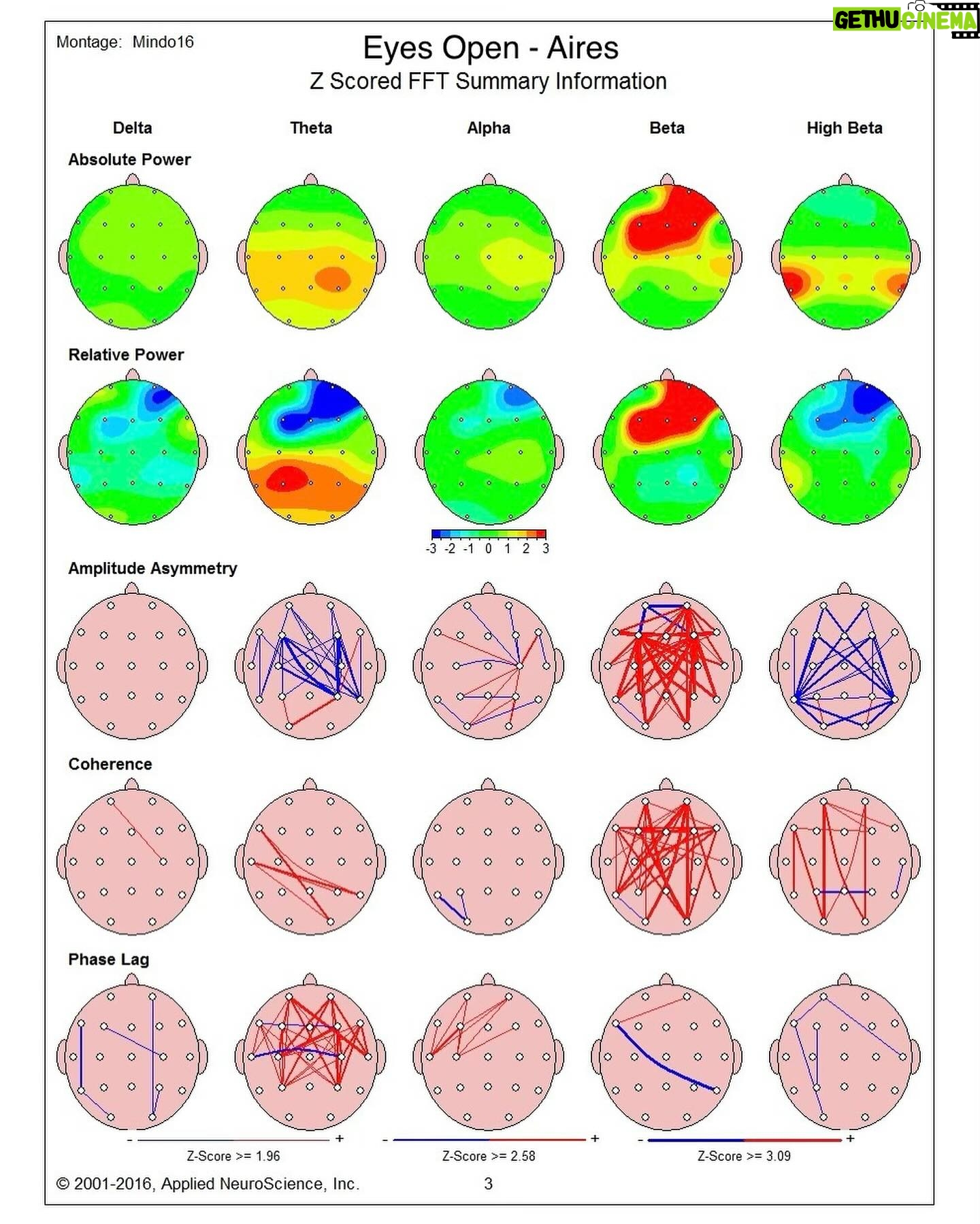 Maycee Barber Instagram - In tune with my brain and body 🧠 @airestech brain mapping is NEXT LEVEL. I learned a lot about how my brain functions and how it can affect my body. Being a professional athlete, it is SO important that I optimize my performance - especially as I approach my next fight. 🥊 This session solidified and validated my intuition since I’ve been using the products, and seeing it happen in real time was crazy. 🤯 I mean…just take a look at those scans 👀 #airesathlete