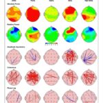 Maycee Barber Instagram – In tune with my brain and body 🧠

@airestech brain mapping is NEXT LEVEL. I learned a lot about how my brain functions and how it can affect my body. Being a professional athlete, it is SO important that I optimize my performance – especially as I approach my next fight. 🥊 This session solidified and validated my intuition since I’ve been using the products, and seeing it happen in real time was crazy. 🤯

I mean…just take a look at those scans 👀 #airesathlete