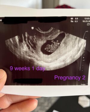 Meagan Martin Instagram - 2022 has been filled with some serious ups and downs. Don’t get me wrong there were some incredible things that happened this year that I’m so thankful for. I think that is all documented on this platform accurately. What isn’t here is the the struggle that my husband @davewetmore1 and I have been going through since this summer. I don’t generally like to share vulnerabilities because overall I am a glass half full happy go lucky kind of person and even now I can see the positives within my current situation. I do however think it’s very important for my mental health, my grieving process, and for anyone else who is going through something similar to share my experience. 

Everyone’s journey with pregnancy and fertility is different, but at the end of the day loss is loss. I had my first miscarriage at 7 weeks pregnant on August 25th of this year. It was extremely sad, but I felt like I was able to stay positive and bounce back from it somewhat quickly. I’m thankful that I didn’t feel shame or embarrassment and I was pretty open with people in person about it. Thank you to everyone who was so kind and positive during that time and to those who felt comfortable sharing their losses with me. Those conversations were immensely helpful. I found out I was pregnant again in October and I felt like this would be it. Every week that passed made me feel more confident. I saw our little gummy bear at 9 weeks and a day with a strong heartbeat and little arms and legs moving around. I felt like I could breathe after that. Yesterday At 12 weeks and 5 days I went in for another ultra sound, only to be met with an unmoving fetus and no heartbeat. This one hurts so much more as I was almost through the first trimester, only to find out we won’t be meeting our baby in July like we thought. Perhaps in the future I’ll share more about how this process has affected me as an athlete because it has been quite difficult. For now I’m just trying to  pick up the pieces again and enter into 2023 hopeful for a better outcome this year and at some point a happy healthy baby. For anyone else who is going through something similar, I hope you stay hopeful too ❤️! #miscarriage