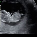 Meagan Martin Instagram – Over the moon to have our double rainbow baby 🌈🌈👶🏽 joining us in December 2023 🥰!!! We started this process over a year ago and it really has been the hardest thing I’ve ever gone through. Through all of the heartbreak and loss @davewetmore1 has been the most incredible partner and I don’t think I could have gotten through this without him. Still have a ways to go, but every piece of good news keeps me going. Watching my belly grow has also brought a new sense of joy and helped with the anxiety that comes with pregnancy, especially after loss. Looking forward to becoming a family of 3 😍!!! #doublerainbowbaby #pregnancyafterloss