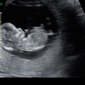 Meagan Martin Instagram - Over the moon to have our double rainbow baby 🌈🌈👶🏽 joining us in December 2023 🥰!!! We started this process over a year ago and it really has been the hardest thing I’ve ever gone through. Through all of the heartbreak and loss @davewetmore1 has been the most incredible partner and I don’t think I could have gotten through this without him. Still have a ways to go, but every piece of good news keeps me going. Watching my belly grow has also brought a new sense of joy and helped with the anxiety that comes with pregnancy, especially after loss. Looking forward to becoming a family of 3 😍!!! #doublerainbowbaby #pregnancyafterloss