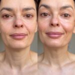 Melânia Gomes Instagram - Antes e depois... Conseguem perceber as diferenças, certo? A minha pele também, depois de ter começado a usar os produtos personalizados de skincare da @mahg.pro , já não quer outra coisa. Até modelar o rosto e corrigir imperfeições eu consigo fazer, sem maquilhagem. Tudo só com os produtos de skincare! Cada pessoa é única, cada pele também e a @mahg.pro faz cada produto especificamente para ti, conforme as características da tua pele, aproveita! Marca uma consulta on-line, para a partir daí ser possível desenvolver os teus produtos, conforme os teus objetivos, as características e necessidades da tua pele. Isto é único! ✨🤍 #skincare #parceria #rotinadedia #personalizada #simples #minimalista #vegan #crueltyfree