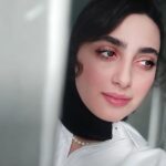 Melika Shaban Instagram – پس از عمل لازک چشمم 🤍😊