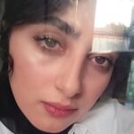 Melika Shaban Instagram – پس از عمل لازک چشمم 🤍😊