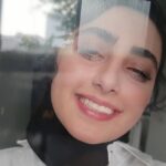 Melika Shaban Instagram – پس از عمل لازک چشمم 🤍😊
