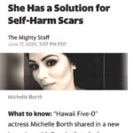 Michelle Borth Instagram - What is “Roll Up Your Sleeves”? Roll Up Your Sleeves is a movement dedicated to those who are suffering the physical scars from mental illness including, self harm, NSSID, drug abuse, and suicide attempts. Many people find it difficult to move forward from the stigma attached and the constant reminders branded on their bodies. We would like to offer a solution, free of cost, to anybody suffering in silence.  Your struggle does not define you, and neither do your scars. I have proudly partnered up with renowned cosmetic surgeon, Doctor Alexander Rivkin, to launch our new campaign Roll Up Your Sleeves, in support of Mental Health Awareness. Roll Up Your Sleeves is an organization designed to help instill confidence and hope to those who suffer with the physical scars from their battle with mental illness, by offering a non-invasive, non-surgical procedure to help diminish the appearance of scars. Dr. Rivkin will be providing this self-created procedure completely pro-bono. His abilities to erase scars that stand as a constant reminder of one’s past, can help a person tremendously move forward on the path to healing and well being. I understand the reality that not everybody can afford the cost of treatment, or may be ashamed to even look for solutions, and this is why we created Roll Up Your Sleeves. I’m so proud to be working with Dr. Rivkin, who is donating his time and expertise, to offer this service at no cost to those in need. Roll Up Your Sleeves is dedicated to help as many people possible put their past behind them, feel confident, and hopeful again. This has been a labor of love of mine for years, Dr. Rivkin and I are so grateful for the enormous amount of support and love we’ve received in just the last 24hrs from all over the world. We are currently working on the website to make it a fully functioning site that will serve as a space for community, support, compassion, and informative resources. Please bare with us while it's under construction. You can still go to the site and subscribe or if you’d like to make an appointment to see Dr. Rivkin please go @westside_aesthetics or call (310) 443-5273. #nostigma #mentalhealthawareness #drrivkin