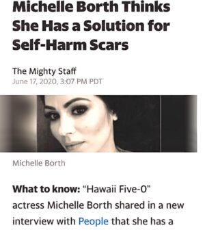 Michelle Borth Instagram - What is “Roll Up Your Sleeves”? Roll Up Your Sleeves is a movement dedicated to those who are suffering the physical scars from mental illness including, self harm, NSSID, drug abuse, and suicide attempts. Many people find it difficult to move forward from the stigma attached and the constant reminders branded on their bodies. We would like to offer a solution, free of cost, to anybody suffering in silence.  Your struggle does not define you, and neither do your scars.
	I have proudly partnered up with renowned cosmetic surgeon, Doctor Alexander Rivkin, to launch our new campaign Roll Up Your Sleeves, in support of Mental Health Awareness. Roll Up Your Sleeves is an organization designed to help instill confidence and hope to those who suffer with the physical scars from their battle with mental illness, by offering a non-invasive, non-surgical procedure to help diminish the appearance of scars.  Dr. Rivkin will be providing this self-created procedure completely pro-bono.  His abilities to erase scars that stand as a constant reminder of one’s past, can help a person tremendously move forward on the path to healing and well being. I understand the reality that not everybody can afford the cost of treatment, or may be ashamed to even look for solutions, and this is why we created Roll Up Your Sleeves.  I’m so proud to be working with Dr. Rivkin, who is donating his time and expertise, to offer this service at no cost to those in need. Roll Up Your Sleeves is dedicated to help as many people possible put their past behind them, feel confident, and hopeful again. This has been a labor of love of mine for years, Dr. Rivkin and I are so grateful for the enormous amount of support and love we’ve received in just the last 24hrs from all over the world. We are currently working on the website to make it a fully functioning site that will serve as a space for community, support, compassion, and informative resources. Please bare with us while it's under construction. You can still go to the site and subscribe or if you’d like to make an appointment to see Dr. Rivkin please go @westside_aesthetics or call (310) 443-5273.	
#nostigma #mentalhealthawareness #drrivkin