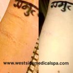 Michelle Borth Instagram - What is “Roll Up Your Sleeves”? Roll Up Your Sleeves is a movement dedicated to those who are suffering the physical scars from mental illness including, self harm, NSSID, drug abuse, and suicide attempts. Many people find it difficult to move forward from the stigma attached and the constant reminders branded on their bodies. We would like to offer a solution, free of cost, to anybody suffering in silence.  Your struggle does not define you, and neither do your scars. I have proudly partnered up with renowned cosmetic surgeon, Doctor Alexander Rivkin, to launch our new campaign Roll Up Your Sleeves, in support of Mental Health Awareness. Roll Up Your Sleeves is an organization designed to help instill confidence and hope to those who suffer with the physical scars from their battle with mental illness, by offering a non-invasive, non-surgical procedure to help diminish the appearance of scars. Dr. Rivkin will be providing this self-created procedure completely pro-bono. His abilities to erase scars that stand as a constant reminder of one’s past, can help a person tremendously move forward on the path to healing and well being. I understand the reality that not everybody can afford the cost of treatment, or may be ashamed to even look for solutions, and this is why we created Roll Up Your Sleeves. I’m so proud to be working with Dr. Rivkin, who is donating his time and expertise, to offer this service at no cost to those in need. Roll Up Your Sleeves is dedicated to help as many people possible put their past behind them, feel confident, and hopeful again. This has been a labor of love of mine for years, Dr. Rivkin and I are so grateful for the enormous amount of support and love we’ve received in just the last 24hrs from all over the world. We are currently working on the website to make it a fully functioning site that will serve as a space for community, support, compassion, and informative resources. Please bare with us while it's under construction. You can still go to the site and subscribe or if you’d like to make an appointment to see Dr. Rivkin please go @westside_aesthetics or call (310) 443-5273. #nostigma #mentalhealthawareness #drrivkin