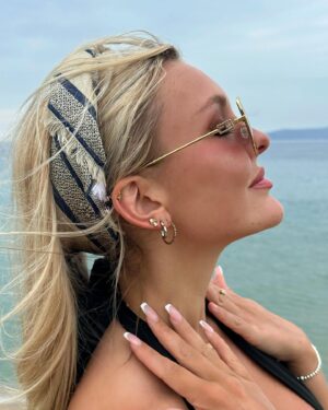 Millie Taylforth Instagram - swipe to see the lucky orphan that flew out to meet me 🥺