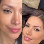 Miriam Saavedra Instagram - La mejor decisión que he podido tomar en mi vida, realizarme el Microblading 😍 maravilloso trabajo @carla_microblading_studio ✍️✨ Después de meditarlo tanto , más de dos años pensando y analizando en manos de quien ponía mis cejas, tenía claro que por supuesto tenía que ser con la mejor especialista experta en Microblading con años de experiencia, pues así su impecable trabajo lo certifica. Carla me ha cambiado la vida resaltando la fuerza y belleza natural de mi mirada enfocada en mis cejas 🤍