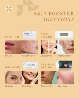 Nina Kozok Instagram - Introducing Nina Kozok @ninakozok for ZAP Premiere.

We bring you the finest solutions to age elegantly, with our complete premium skin booster offered at a value-for-money price.

Ready to age gracefully?

Trust Premiere ✨

#Yourpersonalbeautysolution #zappremiere #NinaKozok