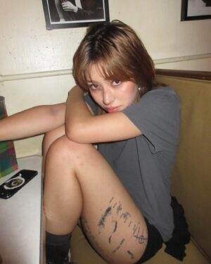 Ninon Instagram - idk where i got these bruises