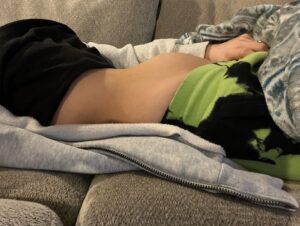 Olivia Kippen Instagram - 💭 💭 💭 As I lie in bed next to my husband right now, I think of what could have been, and how hurt we still feel in silence because of “what could have been, would’ve been”. I feel personally touched by Carmella’s post a few days ago of all her worries during their current pregnancy… I couldn’t imagine the fear they felt, but we celebrate their rainbow baby 💕 all we know is how I felt finding out and being pregnant than suddenly feeling like no one was home anymore, was one of the most absolutely terrible feelings out there. These are all my photos except the  comparison I had of my belly at 10 weeks to a YouTuber’s belly at 10 week with twins, which we were so convinced we were having, because, I mean we were the same size!… however it was a fibroid the size of a cantaloupe accompanying our baby, which caused the miscarriage. I had it removed for our future pregnancies, the scars reminding me everyday of what happened. We like to believe this baby made us aware of the issue that would have caused complications with them and any future babies had we not removed it, and somehow we mentally form some sort of idea of them being some blessing in disguise that was here for a short time for its future siblings that’d be here for a long time. I also want to extend a thank you to those who reached out and shared their experiences and I was unable to respond because I felt so personally touched by all the kind words you all sent and shared, just mentally I wasn’t and still not there to connect with the matter, and I’m sorry for feeling that way just like I feel sorry for myself for somehow feeling like this is all my fault, even when I know it is not.