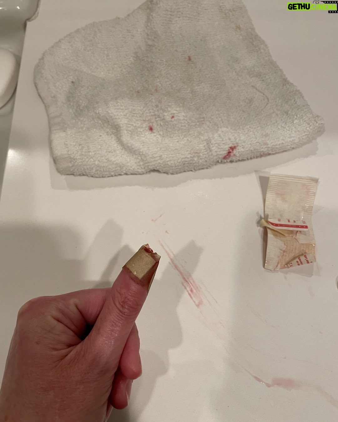 Paget Brewster - 33.1K Likes - Cooking injury.