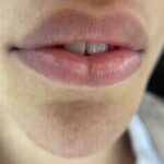 Parisa Roshani Instagram - كانتور لب ❤️ كانتور لب با تكنيك و متريال برند خفن PR😌 ماندگاري ٣ الي ٥ سال شماره رزرو وقت :09128827374 شماره فروش محصولات : 09120030892 ————— رنگ استفاده شده تركيب روبي و پينك شماره ٢ نظرتون چيه ؟؟؟