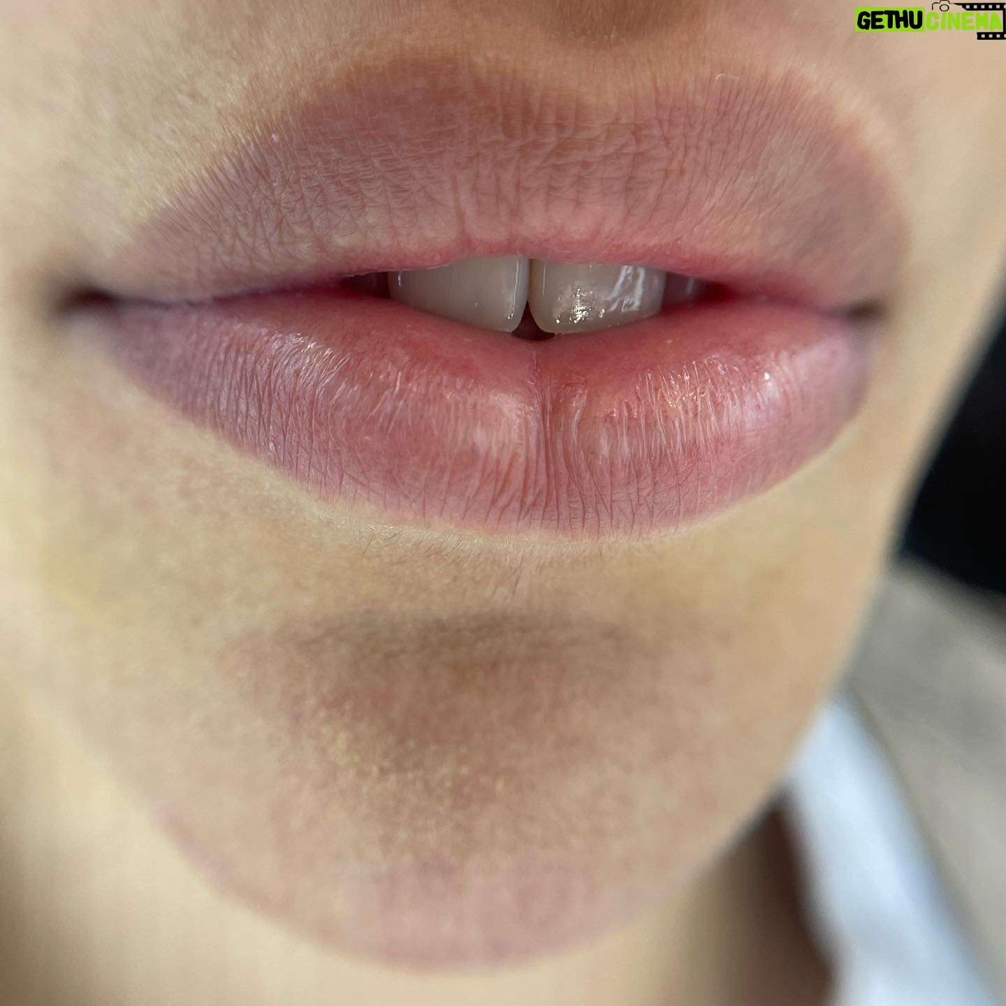 Parisa Roshani Instagram - كانتور لب ❤️ كانتور لب با تكنيك و متريال برند خفن PR😌 ماندگاري ٣ الي ٥ سال شماره رزرو وقت :09128827374 شماره فروش محصولات : 09120030892 ————— رنگ استفاده شده تركيب روبي و پينك شماره ٢ نظرتون چيه ؟؟؟