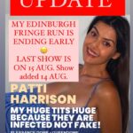 Patti Harrison Instagram - UPDATE: It is with a heavy chest that I have to end my run of shows at Edinburgh Fringe early this year, & must cancel my shows from 16 Aug onward 🥲My last show will now be this Tuesday 15 Aug. I’m sorry to anyone who grabbed tickets for those shows early- you will be refunded. We are adding an additional show this Monday the 14th. 🕊️🥹 This has been the most fun I’ve had doing a show & I am planning more soon 🫦☁️