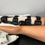 Peyton Evans Instagram – I’m in a hinge brace now. Starting PT this week. I’m scared. I’m in so much pain and I don’t want to have to ever have this surgery again. 

10 days post op. 
#aclremovalrecovery #kneerecoveryjourney #kneerecovery #peytonkaye