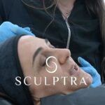 Renata Bravo Instagram – Les presento Sculptra un bioestimulador para activar tu propio colágeno y elastina lo probé, me encantó y se los recomiendo ! Aprovechen la oferta de este mes. www.clinicaavaria.cl/sculptra #antiage