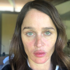 Robin Tunney Instagram - This is what an incredibly sick and rundown middle aged lady  looks like when @jennakristina and @sunniebrook come and transform her to go on tv. Swipe and see what I looked like when I took my makeup off. The people you see on tv and in magazines have the best artists in the business making them look the best they possibly can. When we take the mask off sh** gets real people. Trust me. And watch #thefixabc on Monday.