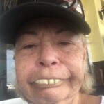 Roseanne Barr Instagram - Lemon teeth