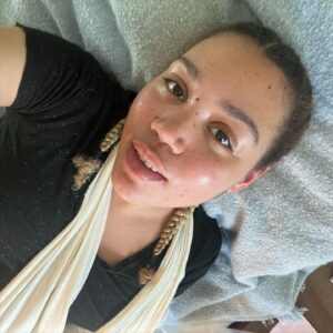 Ruby Barker Instagram - I might be a bit broken but I’m held together with pure gold through the outpouring of love and light over the last few days. Accidents happen literally and figuratively; we all take some falls so let’s perfect how to fall together and know the support is there upon impact. God bless every single one of the gorgeous souls that follow and support me, I owe you so much and I realise that’s not in a picture but in living, breathing, loving, surrendering to survival and getting back on the horse. I will always be an artist. Even if I need to break from professional engagements for a while. But I’ll never stop living, loving and creating beautiful things to share with the world. My family. My followers. My friends. I have lived such a life thus far and can’t wait to share more of it with you. God bless the NHS and please don’t let my lil accident put you off climbing. Climb high. It’s “The Climb” as Miley once put it. But learn how to fall first. Literally and figuratively. Thinking on you always and hope everyone is having a beautiful day. Stay blessed 💕💯💜🎉☝🏾#mentalhealth #climbinglife @lastsundance @nhsengland @merkybooks @augustcharles_ @huw_smallwood #blackgirlmagic #blondeafro #writerscommunity #loveyourself @myladymelts @wellbeinginthearts #mind @mindovermatterwithemma @mindcharity @damekellyholmes @bootspodcast @iagjonathan @julianna_bautista