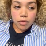 Ruby Barker Instagram - Bank Holiday Horror - please like and share, people need to realise x