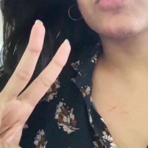 Samyuktha Viswanathan Instagram - I’m a firm believer in authenticity. My IG cannot only be about my wins and highlights, it has to also show the other real life parts, at least those that I’m comfortable sharing.
Every now and then, the universe sends a reminder that I need to take a moment to rest. One time, it was ligament tears, another time it was a third-degree ankle sprain. This time—an injury to my face (which as you can imagine is extremely stressful in this career). Some pain (not too bad thankfully, I have a pretty decent pain threshold), some blood, multiple injections and antibiotics later, I’m much better and so is my face (haha). I sulked a good amount over missing some work/events but was reminded of the ‘burnt toast theory’. So here I am, in acceptance and gratitude that with the good things, some not so good things happen too. And that’s okay. We learn, we rest, we get back up. And I get back to work 🫡

On the bright side, whenever I’m low/sick, my very non-clingy cat suddenly gets affectionate and refuses to leave my side so I’m just gonna enjoy the attention I’m getting from him hehe 🐱

ALSO, it’s eclipse period so if you’re going THROUGH IT, and life’s been a little tough, you are not alone 🫂🧿

#authenticself #burnttoasttheory #eclipseseason #notjusthighlights