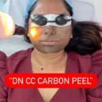 Saraswathi kuna Instagram - DN Carbon Peel with CC Soothing will be your perfect combination for various Skin Issues. Please visit for a Consultation for us to suggest Best Treatment for your Concern. Reach us on 7799021222 to book your Appointment and for enquiries. #deeptinadiminti #deeptinadimintipmu #dncarbonpeel #dnccglow #ccglowbydn