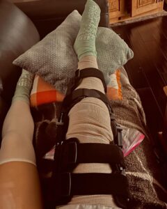 Savannah Kristich Instagram - july 19, exactly two months ago today, i tore both my ACL and medial meniscus. i had done a back aerial and once i landed on my right leg, my knee had completely inverted on heavy impact. once it happened i fell to the floor and just laid there. i didnt cry or yell, but i laid on the ground breathing extremely hard. when people ran over to see what was wrong, they helped me sit up and calm down. at first, i really thought that i was going to be okay and at worst it would just be a sprain. the following weeks after, i made sure to rest and elevate in hope that it was going to get better. however, things weren’t looking too good.my swelling was not going down, i couldn’t straighten my leg, and i was in constant pain. the first visit with the doctor informed me that there was a possibility that my acl had torn, but to take that info with a grain of salt. the doctor had told me that i needed an mri to get a clear answer as to what was wrong. as i waited for the results, i felt like my knee was getting better. i was able to put pressure on it, and i had really thought that nothing severe was wrong with it. but when my mom had told me the news of tearing not only my acl, but also my meniscus i immediately broke down. in that moment it felt as though my world had crashed. dance is the love of my life, and it is the one thing that makes me feel something. all of my dreams of going away to college for dance, performing, and moving forward in my career felt like they were thrown out the window. i couldn’t imagine the thought of going through surgery, completely retraining my leg to function, and not being able to dance for 9 months.as i waited for surgery, i worked on pre-op training all on my own to be able to bend my knee 120 degrees again as well as straightening it. over the course of time, i was walking again and gained back most of my flexion in my leg, but it was incredibly painful. today i had my surgery, and i was scared to death.but i woke of from the operation and was told that my surgery went extremely well. now i am on the road to recovery and trying to keep a positive outlook. God is good and things will get better❤️‍🩹