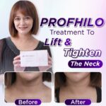 Sazzy Falak Instagram – Taking care of your face doesn’t show your age, but you know what betrays you? Your neck! Neck lines and wrinkles reveal your true age, but don’t worry—treatments like Profhilo can be done on the neck to reduce neck lines, tighten the skin, and refresh it. Always remember to scan the QR code on the Profhilo box to verify its authenticity. Mother’s Day is over, but you can still treat them as our promo is until month-end! Book your Profhilo treatment with us today! ✨

@profhilo_sea #ProfhiloSEAMothersday #ProfhiloforNeck #ProfhiloSEA
