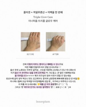 Shin Joo-ah Instagram - 날씨 너무 덥네용
더위조심용🙏🙏
모두 건강 잘 챙겨야해요요❤️🦾

많이 찾아주시는 글로우케어
후기도 정리해왔는데 뒷장 쭉- 확인해주세용!

오늘은 제가 하고 있는 화사한 피부를 위한 루틴!
간단하게 소개해 드릴게용

✔이너피움 트리플 글로우케어
계속 말씀드리지만 엄청난 임상결과! 
피부 밝기 개선 3,700%를 자랑하는
원료가 하루 충족량 가득! 들어있어용
자외선에 의한 피부 손상을 보호 도움주는
개별인정형 원료로 등록되어 있으니
더욱 신뢰 있게 꾸준히 먹는 저희 이너뷰티 아이템✨

✔선크림
선크림은 365일 내내 필수 아이템이구
지금 같은 여름은 더더 꾸준히!
자주 발라주고 있어용 외출 20분 전에
쓱쓱 발라주는데 피부가 예민하다보니
순하고 눈 시림 없는 선크림으로 사용중😍

✔️수분템
수분은 피부 관리의 기본이고 제일 중요하쥬
피부가 건조하면 트러블, 탄력, 생기 
다 문제가 생기다 보니 속부터 탄탄하게
만들어주면 자연스럽게 생기도 up!

여러분의 화사한 피부 꿀템도 있으시면
공유해주세용 😍 

#피부루틴#피부지킴이