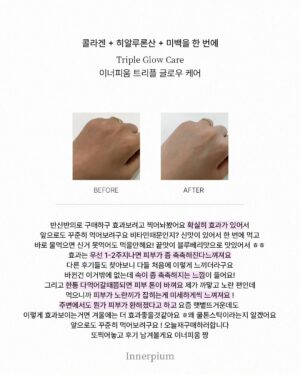 Shin Joo-ah Instagram - 날씨 너무 덥네용
더위조심용🙏🙏
모두 건강 잘 챙겨야해요요❤️🦾

많이 찾아주시는 글로우케어
후기도 정리해왔는데 뒷장 쭉- 확인해주세용!

오늘은 제가 하고 있는 화사한 피부를 위한 루틴!
간단하게 소개해 드릴게용

✔이너피움 트리플 글로우케어
계속 말씀드리지만 엄청난 임상결과! 
피부 밝기 개선 3,700%를 자랑하는
원료가 하루 충족량 가득! 들어있어용
자외선에 의한 피부 손상을 보호 도움주는
개별인정형 원료로 등록되어 있으니
더욱 신뢰 있게 꾸준히 먹는 저희 이너뷰티 아이템✨

✔선크림
선크림은 365일 내내 필수 아이템이구
지금 같은 여름은 더더 꾸준히!
자주 발라주고 있어용 외출 20분 전에
쓱쓱 발라주는데 피부가 예민하다보니
순하고 눈 시림 없는 선크림으로 사용중😍

✔️수분템
수분은 피부 관리의 기본이고 제일 중요하쥬
피부가 건조하면 트러블, 탄력, 생기 
다 문제가 생기다 보니 속부터 탄탄하게
만들어주면 자연스럽게 생기도 up!

여러분의 화사한 피부 꿀템도 있으시면
공유해주세용 😍 

#피부루틴#피부지킴이