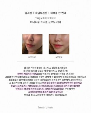 Shin Joo-ah Instagram - 날씨 너무 덥네용
더위조심용🙏🙏
모두 건강 잘 챙겨야해요요❤️🦾

많이 찾아주시는 글로우케어
후기도 정리해왔는데 뒷장 쭉- 확인해주세용!

오늘은 제가 하고 있는 화사한 피부를 위한 루틴!
간단하게 소개해 드릴게용

✔이너피움 트리플 글로우케어
계속 말씀드리지만 엄청난 임상결과! 
피부 밝기 개선 3,700%를 자랑하는
원료가 하루 충족량 가득! 들어있어용
자외선에 의한 피부 손상을 보호 도움주는
개별인정형 원료로 등록되어 있으니
더욱 신뢰 있게 꾸준히 먹는 저희 이너뷰티 아이템✨

✔선크림
선크림은 365일 내내 필수 아이템이구
지금 같은 여름은 더더 꾸준히!
자주 발라주고 있어용 외출 20분 전에
쓱쓱 발라주는데 피부가 예민하다보니
순하고 눈 시림 없는 선크림으로 사용중😍

✔️수분템
수분은 피부 관리의 기본이고 제일 중요하쥬
피부가 건조하면 트러블, 탄력, 생기 
다 문제가 생기다 보니 속부터 탄탄하게
만들어주면 자연스럽게 생기도 up!

여러분의 화사한 피부 꿀템도 있으시면
공유해주세용 😍 

#피부루틴#피부지킴이