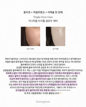 Shin Joo-ah Instagram - 날씨 너무 덥네용
더위조심용🙏🙏
모두 건강 잘 챙겨야해요요❤️🦾

많이 찾아주시는 글로우케어
후기도 정리해왔는데 뒷장 쭉- 확인해주세용!

오늘은 제가 하고 있는 화사한 피부를 위한 루틴!
간단하게 소개해 드릴게용

✔이너피움 트리플 글로우케어
계속 말씀드리지만 엄청난 임상결과! 
피부 밝기 개선 3,700%를 자랑하는
원료가 하루 충족량 가득! 들어있어용
자외선에 의한 피부 손상을 보호 도움주는
개별인정형 원료로 등록되어 있으니
더욱 신뢰 있게 꾸준히 먹는 저희 이너뷰티 아이템✨

✔선크림
선크림은 365일 내내 필수 아이템이구
지금 같은 여름은 더더 꾸준히!
자주 발라주고 있어용 외출 20분 전에
쓱쓱 발라주는데 피부가 예민하다보니
순하고 눈 시림 없는 선크림으로 사용중😍

✔️수분템
수분은 피부 관리의 기본이고 제일 중요하쥬
피부가 건조하면 트러블, 탄력, 생기 
다 문제가 생기다 보니 속부터 탄탄하게
만들어주면 자연스럽게 생기도 up!

여러분의 화사한 피부 꿀템도 있으시면
공유해주세용 😍 

#피부루틴#피부지킴이