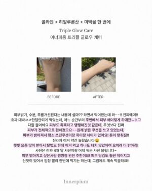 Shin Joo-ah Instagram - 날씨 너무 덥네용
더위조심용🙏🙏
모두 건강 잘 챙겨야해요요❤️🦾

많이 찾아주시는 글로우케어
후기도 정리해왔는데 뒷장 쭉- 확인해주세용!

오늘은 제가 하고 있는 화사한 피부를 위한 루틴!
간단하게 소개해 드릴게용

✔이너피움 트리플 글로우케어
계속 말씀드리지만 엄청난 임상결과! 
피부 밝기 개선 3,700%를 자랑하는
원료가 하루 충족량 가득! 들어있어용
자외선에 의한 피부 손상을 보호 도움주는
개별인정형 원료로 등록되어 있으니
더욱 신뢰 있게 꾸준히 먹는 저희 이너뷰티 아이템✨

✔선크림
선크림은 365일 내내 필수 아이템이구
지금 같은 여름은 더더 꾸준히!
자주 발라주고 있어용 외출 20분 전에
쓱쓱 발라주는데 피부가 예민하다보니
순하고 눈 시림 없는 선크림으로 사용중😍

✔️수분템
수분은 피부 관리의 기본이고 제일 중요하쥬
피부가 건조하면 트러블, 탄력, 생기 
다 문제가 생기다 보니 속부터 탄탄하게
만들어주면 자연스럽게 생기도 up!

여러분의 화사한 피부 꿀템도 있으시면
공유해주세용 😍 

#피부루틴#피부지킴이