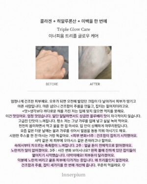 Shin Joo-ah Instagram - 날씨 너무 덥네용
더위조심용🙏🙏
모두 건강 잘 챙겨야해요요❤️🦾

많이 찾아주시는 글로우케어
후기도 정리해왔는데 뒷장 쭉- 확인해주세용!

오늘은 제가 하고 있는 화사한 피부를 위한 루틴!
간단하게 소개해 드릴게용

✔이너피움 트리플 글로우케어
계속 말씀드리지만 엄청난 임상결과! 
피부 밝기 개선 3,700%를 자랑하는
원료가 하루 충족량 가득! 들어있어용
자외선에 의한 피부 손상을 보호 도움주는
개별인정형 원료로 등록되어 있으니
더욱 신뢰 있게 꾸준히 먹는 저희 이너뷰티 아이템✨

✔선크림
선크림은 365일 내내 필수 아이템이구
지금 같은 여름은 더더 꾸준히!
자주 발라주고 있어용 외출 20분 전에
쓱쓱 발라주는데 피부가 예민하다보니
순하고 눈 시림 없는 선크림으로 사용중😍

✔️수분템
수분은 피부 관리의 기본이고 제일 중요하쥬
피부가 건조하면 트러블, 탄력, 생기 
다 문제가 생기다 보니 속부터 탄탄하게
만들어주면 자연스럽게 생기도 up!

여러분의 화사한 피부 꿀템도 있으시면
공유해주세용 😍 

#피부루틴#피부지킴이