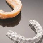 Sireesha Bhagavatula Instagram - Wireless teeth straightening 💜TRANSPERA ALIGNERS 💜 Always trust your dentist/ orthodontist for aligner treatment. Transpera Aligners are designed by Team of Orthodontists. Teeth are precious and sensitive tools. Say No to DIY aligners or online aligners… as they can damage your precious teeth. That’s why there is no substitute for seeing trained experts when trying to improve your smile. They have all the necessary equipment, experience, and knowledge to align your teeth the right way. So instead of spending a little less on a DIY clear aligner, the best choice is still visiting a certified orthodontist who will treat your teeth with the care and attention you need. . . . #nodiyaligners #clearaligners #clearalignertherapy #orthodontist #dentist #trustyourdentist #trustyourorthodontontist #bestdentalclinic #dentalclinicnearyou #bestdentalclinicvizag #trendingreels #vizag #vizagcelebrities #viralvideos