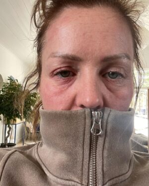 Siri Kristiansen Instagram - Sånn ser man ut etter seks dager med høy feber. Da er ok at kveldens episode av Arveoppgjøret ikke er live si..
Denne gangen hjelper vi familien Nordheggen på Hadeland, hvor blandt annet familiegården skal diskuteres. 
@nrk #arveoppgjøret