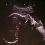 Sofia Arruda Instagram - As “fotografias” da nossa princesa 🥰 Não vemos a hora de te pegar ao colo, mas por enquanto ficas no forninho até à Primavera 🌸 #babygirl #pregnancyjourney #love