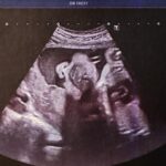 Sofia Arruda Instagram - As “fotografias” da nossa princesa 🥰 Não vemos a hora de te pegar ao colo, mas por enquanto ficas no forninho até à Primavera 🌸 #babygirl #pregnancyjourney #love