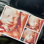 Sofia Arruda Instagram - Chegámos ao 8 mês e estamos cada vez mais perto de conhecer (melhor) a nossa babygirl! Entretanto temos esta fotografia 5D que fizemos na @mami4d5d e que nos faz sonhar com uma bochechinhas fofa 🥰 #8mothns #babygirl #newbabysoon #countdown #oferta