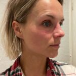 Stijn Fransen Instagram - Redder in nood 🆘 Voor iedereen die de Cicaplast Baume B5 niet kent. Dit is echt je redder in nood in alle omstandigheden. Zoals je op de foto ziet had ik gisteravond opeens een mega eczeem uitbraak. Dus dan doen ik er een laagje op voordat ik ga slapen. Maar ook op Lieuwe zijn billen is het super fijn. Met dit weer als de kloven in mijn vingers springen. Oprecht in elke tas samen met mijn Cicaplast lippenbalsem zit een tube Cicaplast Baume B5. En nou is die vernieuwd er staat een achter de 5. Het Herstelt optimaal de huidbarrière: Madecassoside Koper - Zink - Mangaan Tribioma. Verzacht droge, geïrriteerd aanvoelende zones: 5% Panthenol. En beschermt de huid: Rijke en voedende textuur. #proudambasaseur #trotseambassadeur #ambassador #LRP #cicaplast #baumeb5 #publiciteit @larocheposay