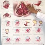 Taylour Paige Instagram - Just a girl, and the things that make up this beautiful life and pelvic floor therapy for endometriosis whomever needed to know and is struggling! I didn’t!