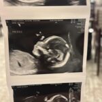Valentine Thomas Instagram – Expectations vs. Reality 😂💙 Well, I guess life got real for @danielf86 and I 5 months ago! When I got super sick over the holidays, I decided to go do some blood tests to make sure everything was ok. When they asked me if I wanted to check if I was pregnant I said “nah it’s not that, I’m loosing too much weight!”. Well, it was that ha! At 36yo, considered “geriatric” pregnancy wise and catching Listeria in Nicaragua, I, we wanted to cherish the news for a while and honestly, process that after 36 years of doing what the heck we both wanted, life isn’t about us anymore, and will never be again. We are insanely excited to expect a little girl, and can’t wait to teach her how to fish, drive manual, snowboard, surf, catching her own food and a lot more!! Although if she is half the pain I was as a kid, good luck to us 😂 hopefully she will have Daniel’s personality and not my sass 🙃
