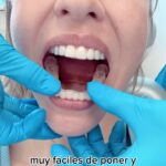 Valeria Ortega Instagram - Estoy en 🔥 porque empecé mi tratamiento con @invisalignlatam en @clinicaismile con la máxima @docbarb_ismile Usé brackets hace años, pero esta tecnología es otro nivel!! Se pasó! Es maravilloso! Llevo una semana y voy como avión. Me los saco para comer, luego me lavo los dientes y lavo los alineadores (prefiero tener un cepillo aparte). Duermo con ellos y no se sienten (y yo con bruxismo!). Hasta podemos adelantar como se van a ver al final del tratamiento. La próxima semana tengo otro chequeo y ahí veré que tal avanzamos. Ya no ceseo tanto 😂 me acostumbré rápido ✨🦷 ✨